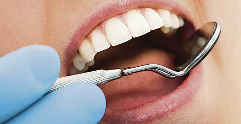 tratamiento dental una sesión